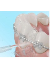 ToothCare 1100 Jet Liberty / 4314